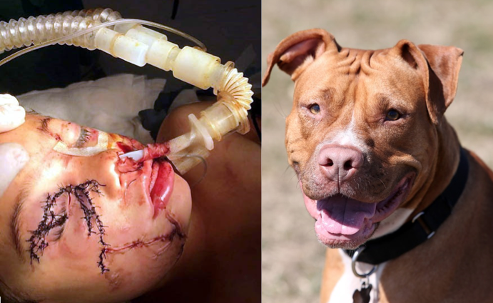 do pit bulls attack other dogs